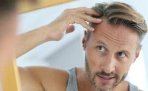 psicologia caduta capelli